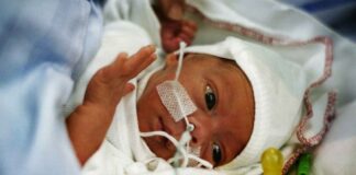 Synsregistret viser historisk udvikling for tidligt født baby ligger med sonde og kigger på sin sut