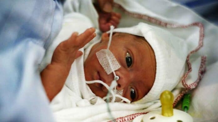 for tidligt født baby ligger med sonde og kigger på sin sut